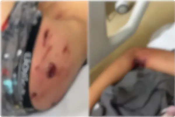 Criança é atacada por pitbull ao buscar pipa na casa de vizinho em GO (Foto: Reprodução/ Polícia Militar)