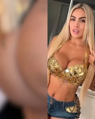 Juju Ferrari divulga fotos de como ficou seu corpo após infecção