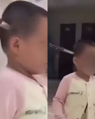 Mãe revela verdade chocante após filha ser internada com faca cravada na cabeça  (Foto: Reprodução/Redes sociais)