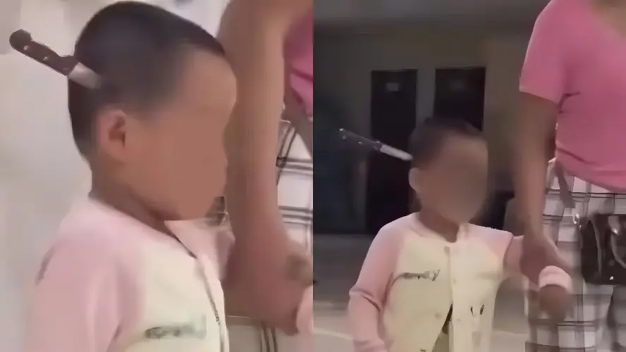 Menina de 3 anos é levada a hospital com faca cravada na cabeça após ataque da mãe (Foto: Reprodução/Redes Sociais)