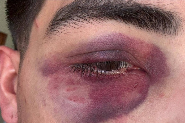 Empresário diz ter sido agredido em karaokê famoso, em SP