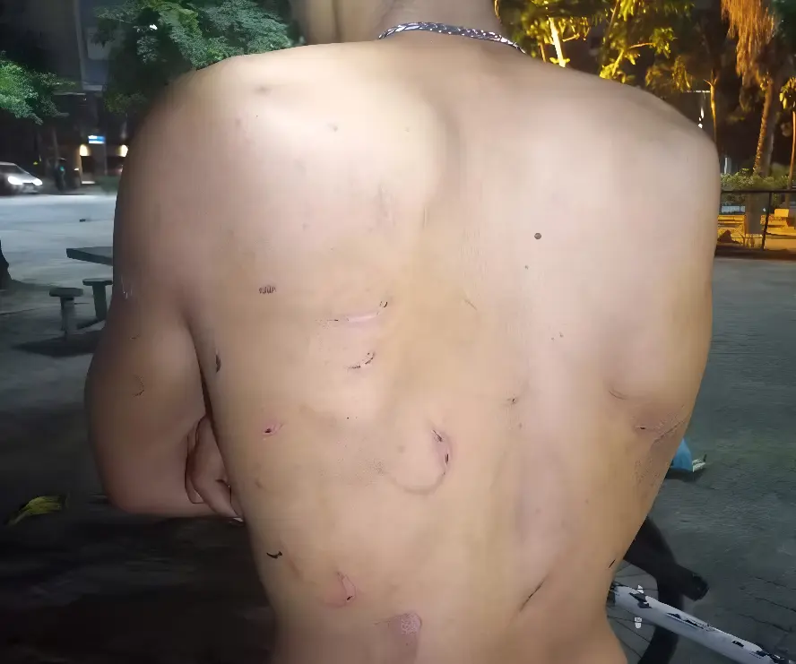 Jovem denunciou agressões físicas (Foto: Reprodução/Redes Sociais)