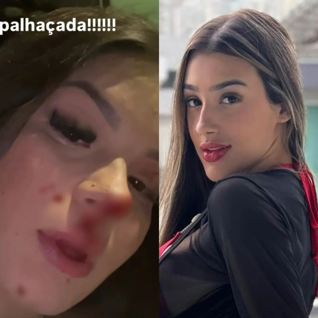 Modelo revela detalhes sobre as agressões em balada (Foto: reprodução)