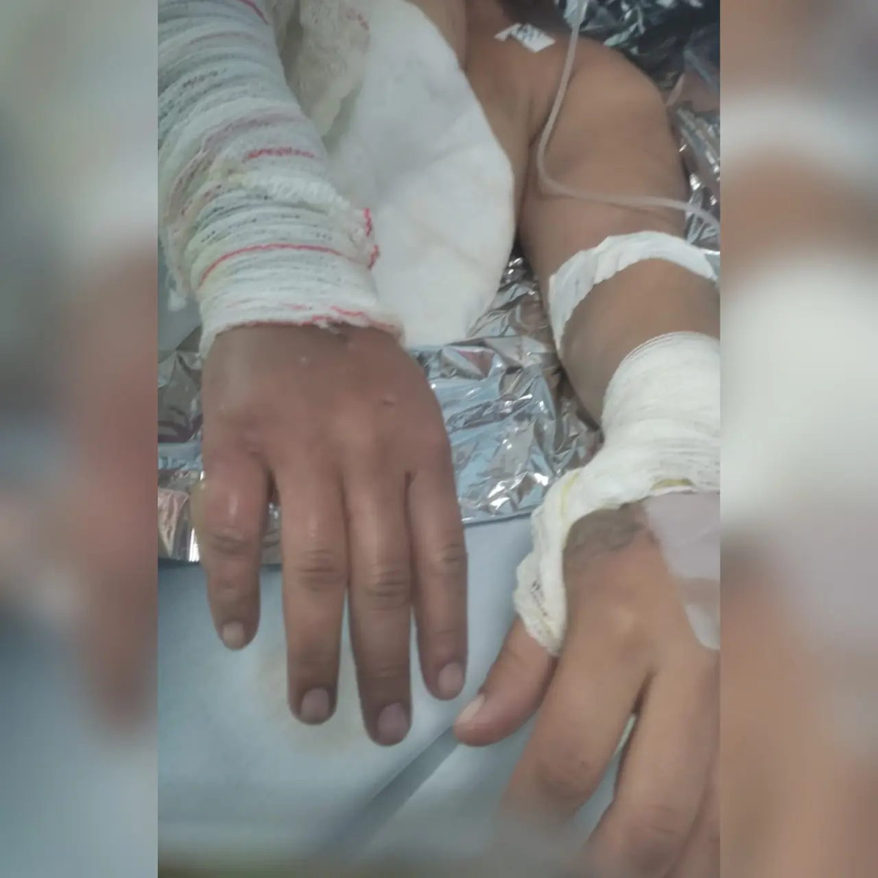 Mulher é queimada viva pelo ex-marido na frente das amigas; veja os detalhes