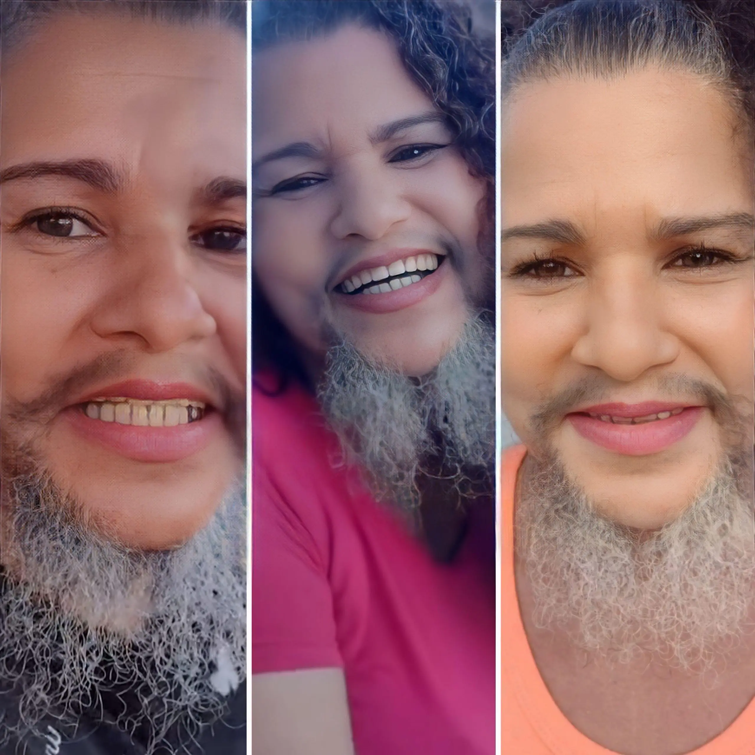 Mulher Barbada: Moradora em Maceió desafia padrões e assume barba