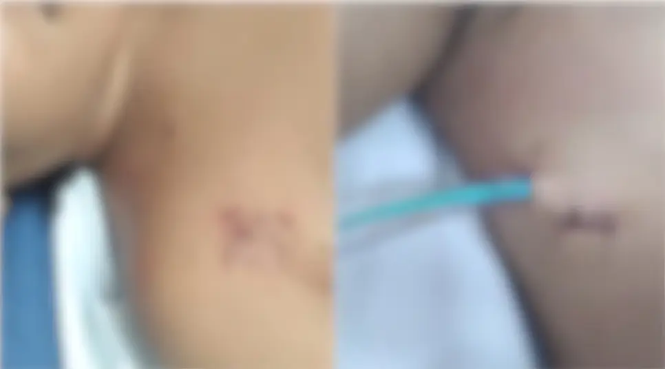 Adolescente grávida é esfaqueada com chave de fenda em Quixeramobim; suspeito está foragido (Foto: Arquivo Pessoal)