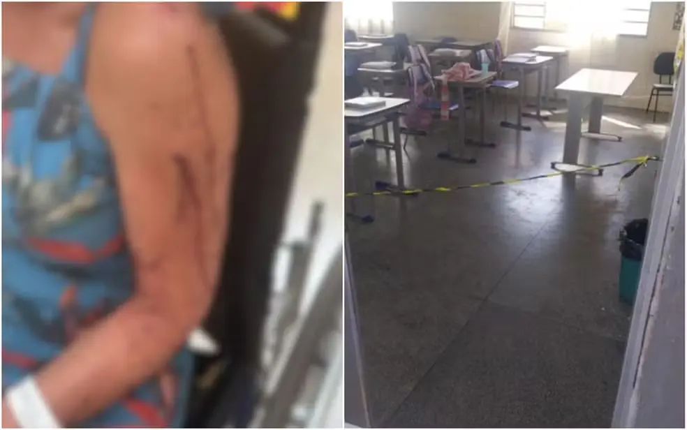 Atacada com faca por aluna de 14 anos: saiba o estado de saúde da professora
