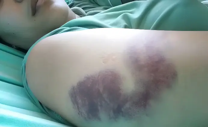Mulher é agredida por motorista de aplicativo após discussão (Foto: Arquivo Pessoal)