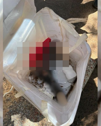 Motivo macabro: Pé humano é encontrado em meio a recicláveis (Foto: Reprodução)