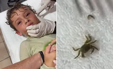 Confira o momento em que caranguejo é retirado de ouvido de criança