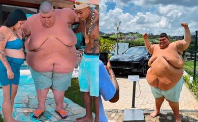 Gordão da XJ elimina 115kg e vai realizar cirurgia bariátrica; veja antes e depois