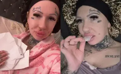 Síndrome de pica: mulher descobre doença rara aos 34 anos e sofre com sintomas