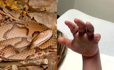 Cobra venenosa pica criança e creche não aciona emergência; entenda o motivo