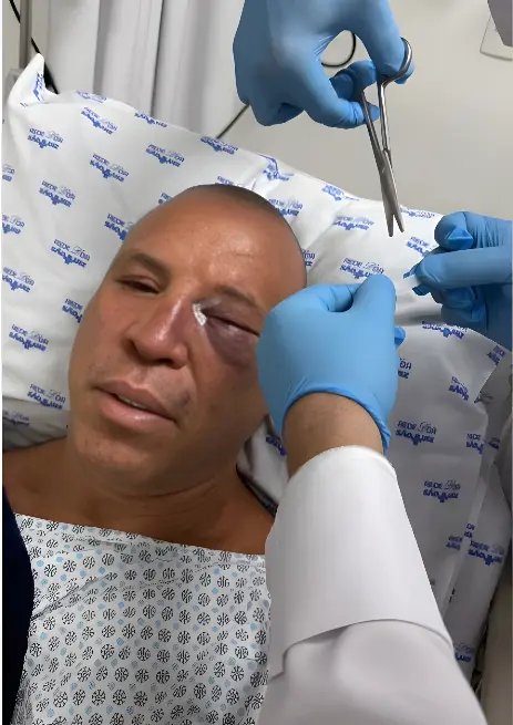 Wanderlei Silva é nocauteado fora de hora e vai parar no hospital com nariz quebrado (Foto: Redes Sociais)