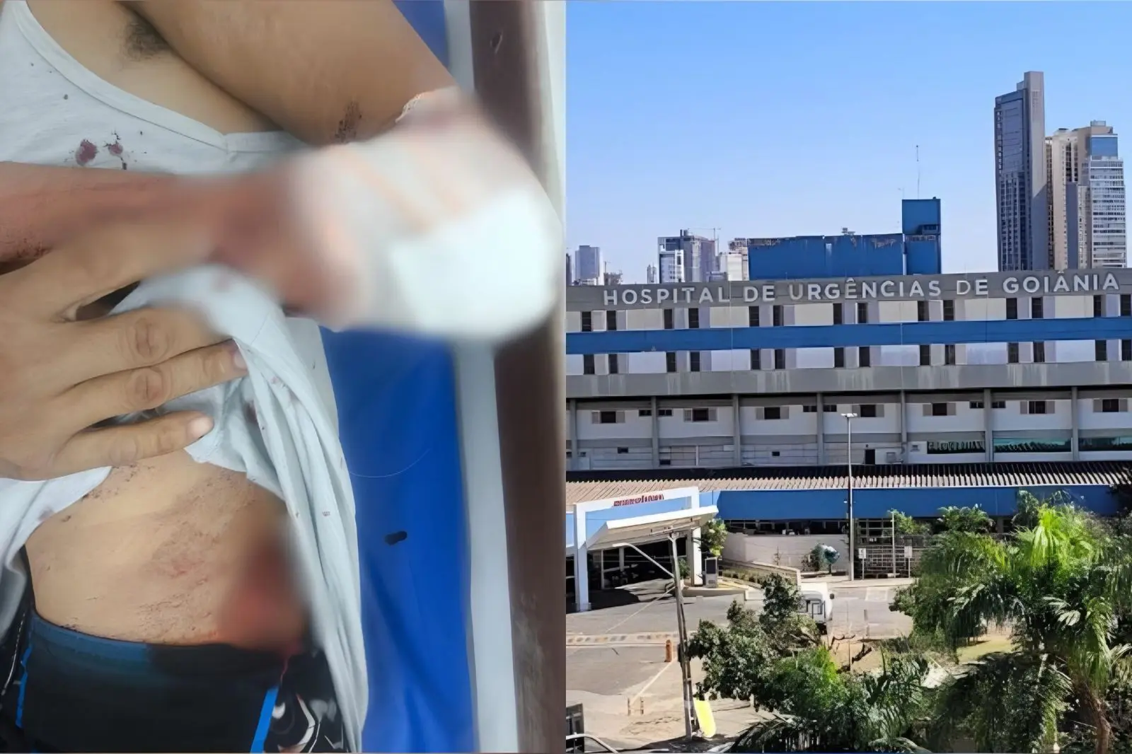 Vítima foi levada para o Hospital de Urgências de Goiás devido à gravidade dos ferimentos. (Foto: Reprodução)
