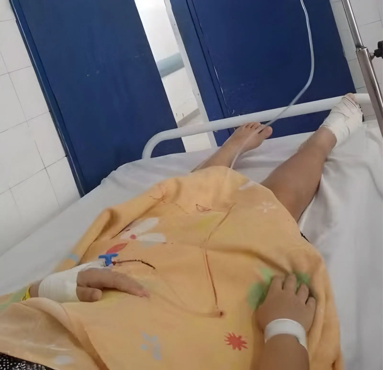 Menina de 8 anos perde dedo do pé em brinquedo da Praça da Infância (Foto: Reprodução/G1)