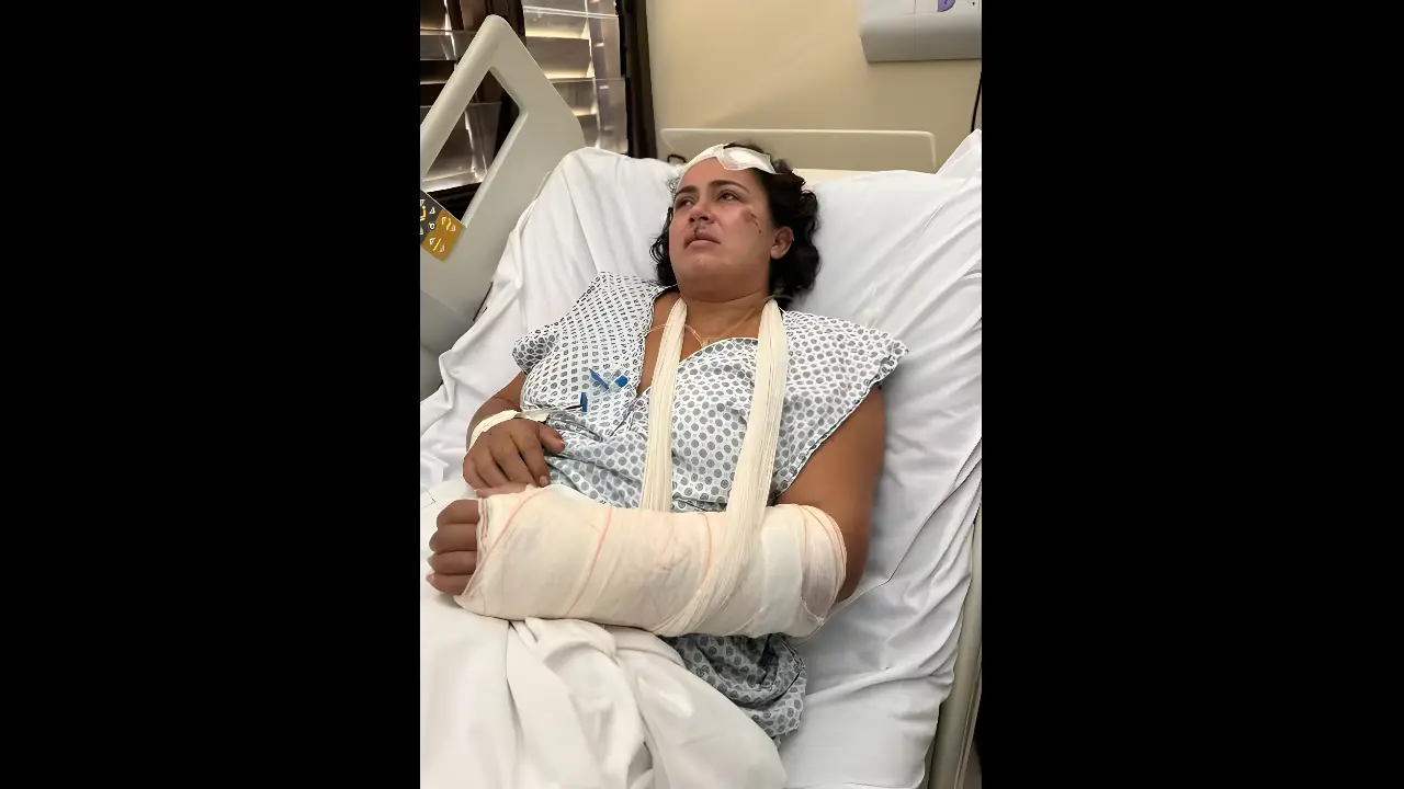 Vítima da agressão precisou passar por cirurgias de reconstrução. (Reprodução)