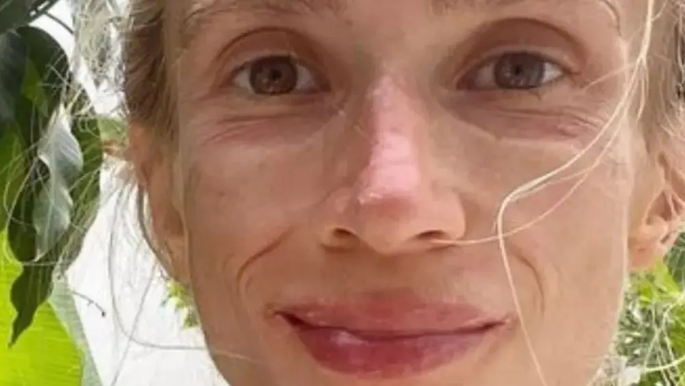 Mulher é encontrada morta em hotel pesando apenas 22 quilos