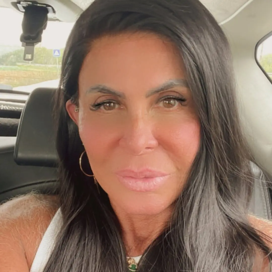 Gretchen faz nova harmonização facial e revela motivo