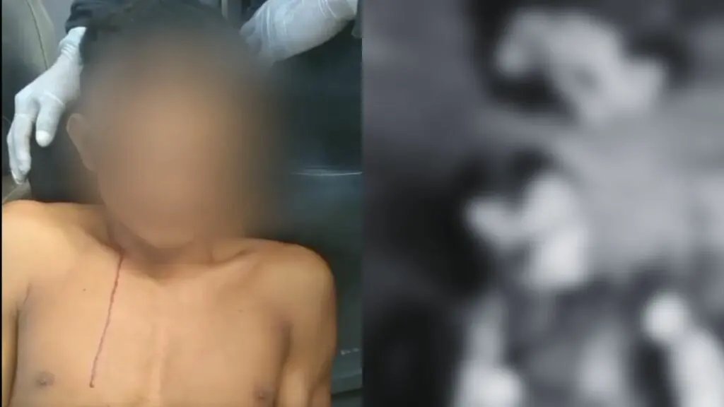 Jovem indígena confessa ter esquartejado os próprios irmãos; veja vídeo