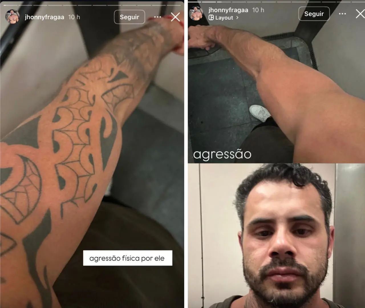 Jhonny Fraga - Criador compartilhou nas redes que foi agredido pelo companheiro - Imagens-Reprodução: Redes Sociais 