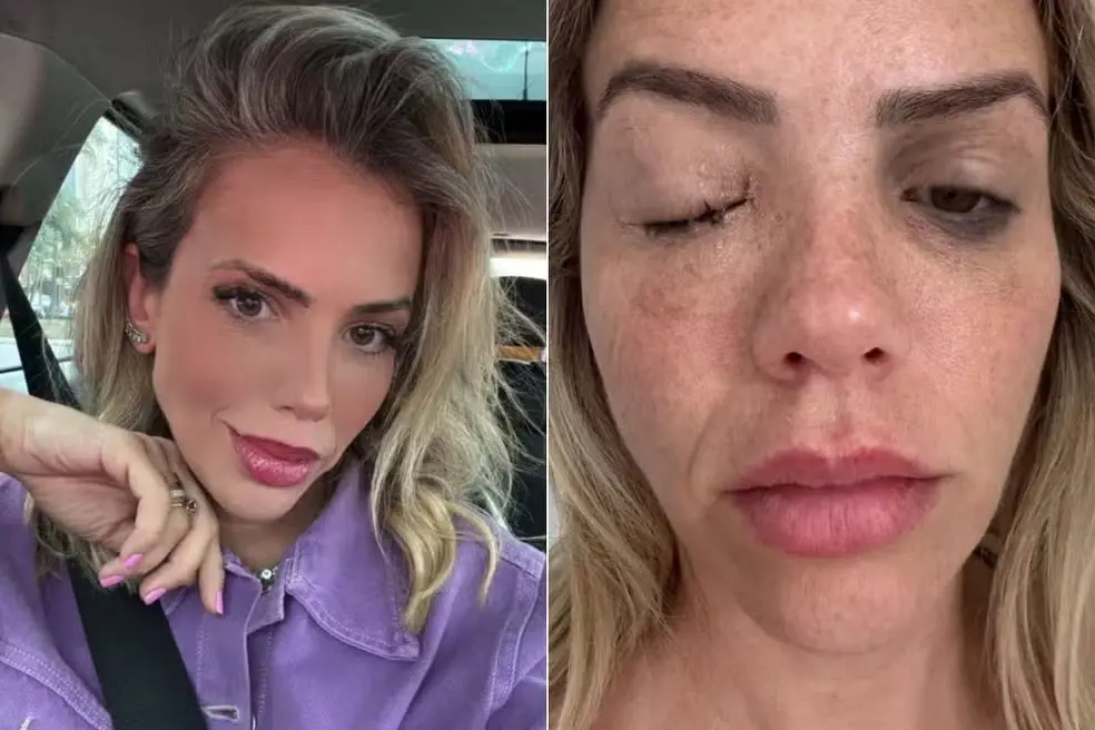 Apresentadora enfrenta bactéria rara e perigosa, capaz de causar cegueira (Foto: Reprodução/Redes sociais)