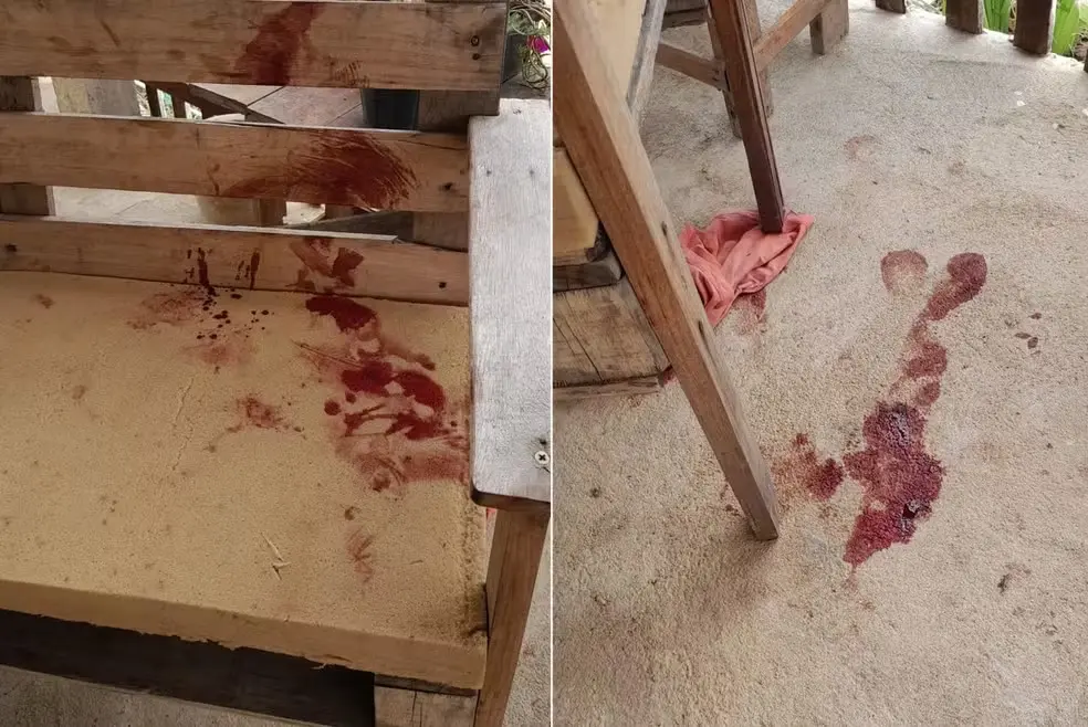 Bebê de 10 meses é atacado por pitbull e fica gravemente ferido (Foto: Reprodução/Campos Ocorrências)