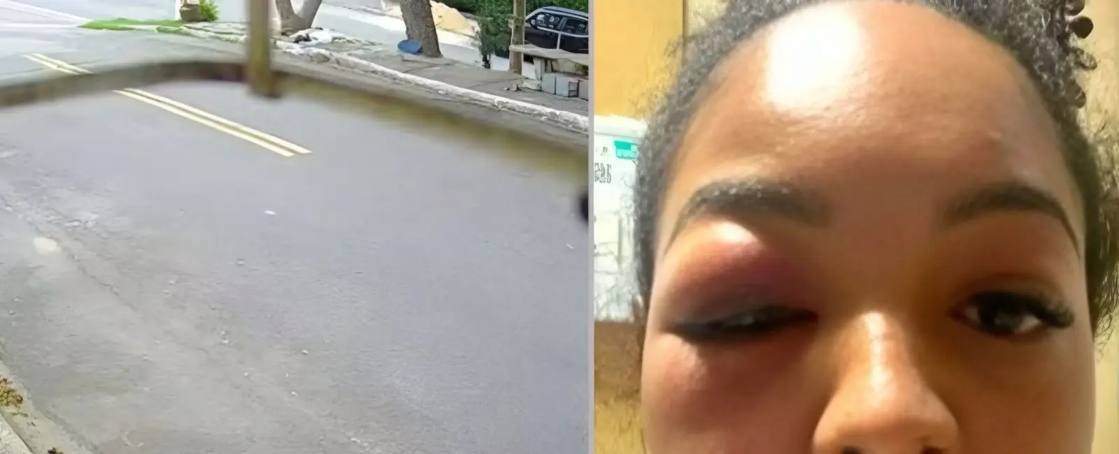 Mulher é espancada em tentativa de estupro e precisará reconstruir o rosto (Foto: Arquivo Pessoal)