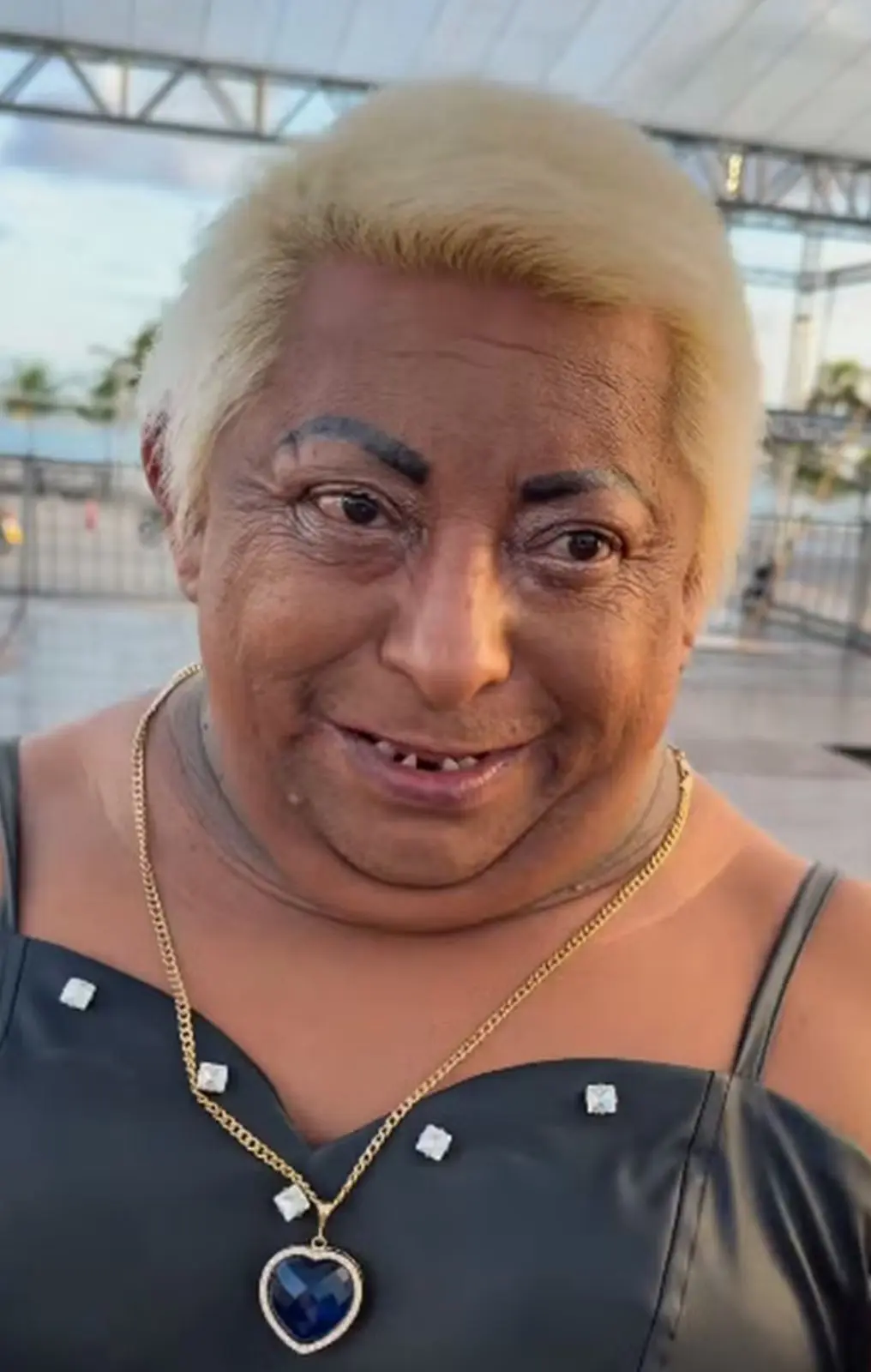 Patixa Teló exibe novo sorriso após procedimento estético. Veja fotos