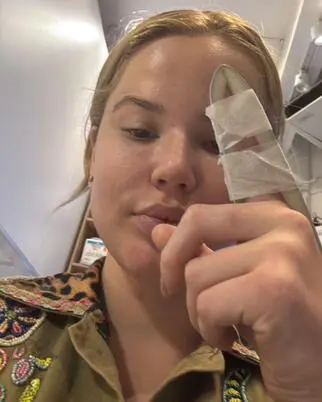 Namorada de Dolabella, que faz uso de medicação controlada, está disposta a reatar com o agressor