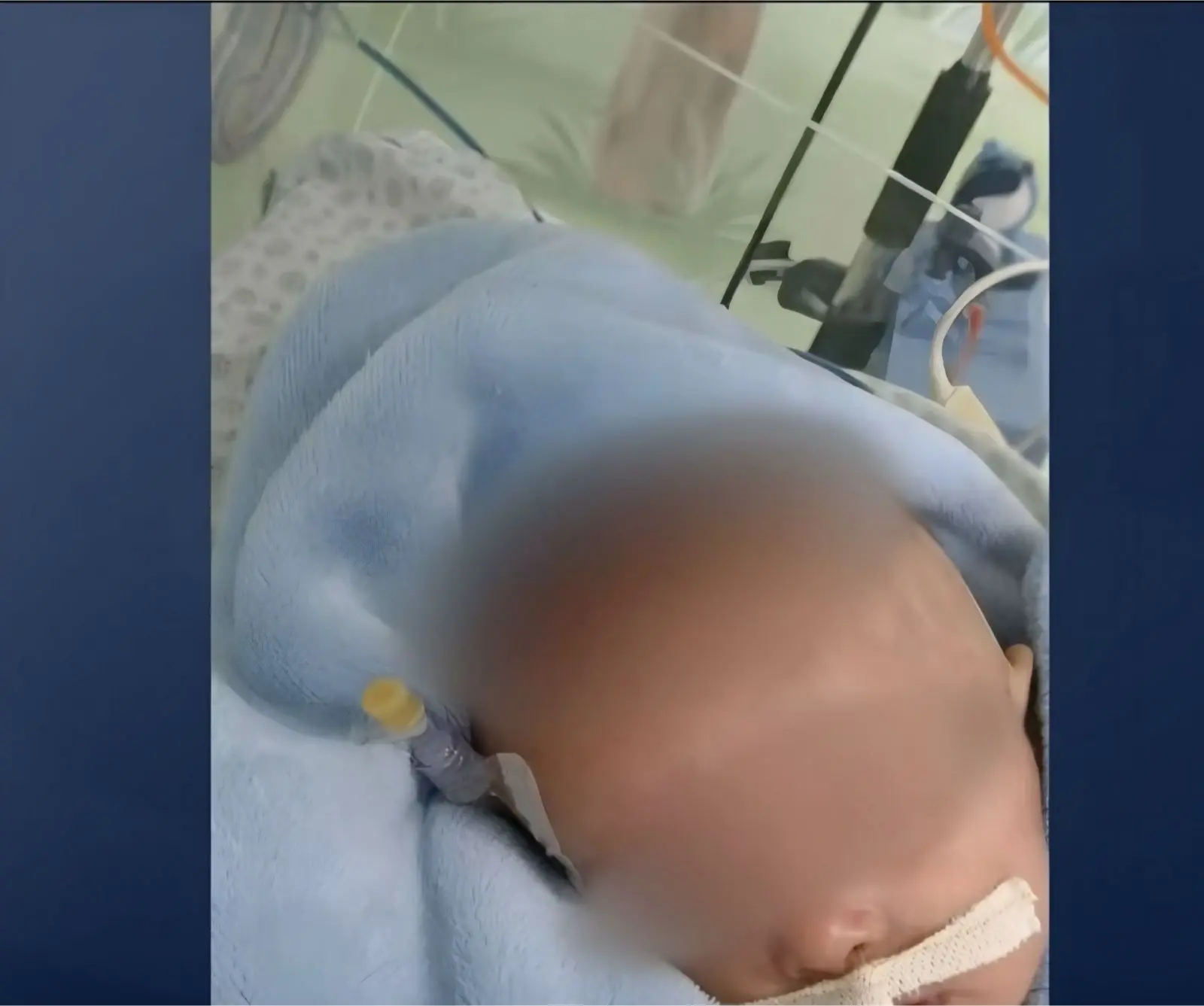 Bebê morre e irmã gêmea fica ferida após pai jogar crianças em banho quente  (Foto: Reprodução/SBT)