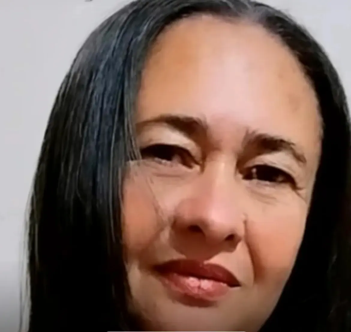 vitima teve o intestino perfurado durante uma colonoscopia