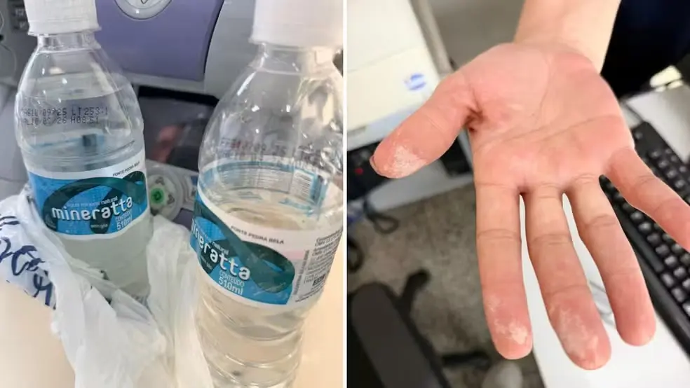 Homem é hospitalizado com sintomas de intoxicação após beber água (Foto: Reprodução)