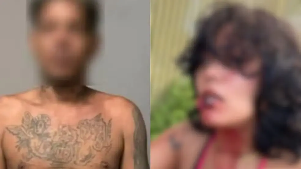 Jovem que teve lábio ‘comido’ pelo ex revela momentos de terror