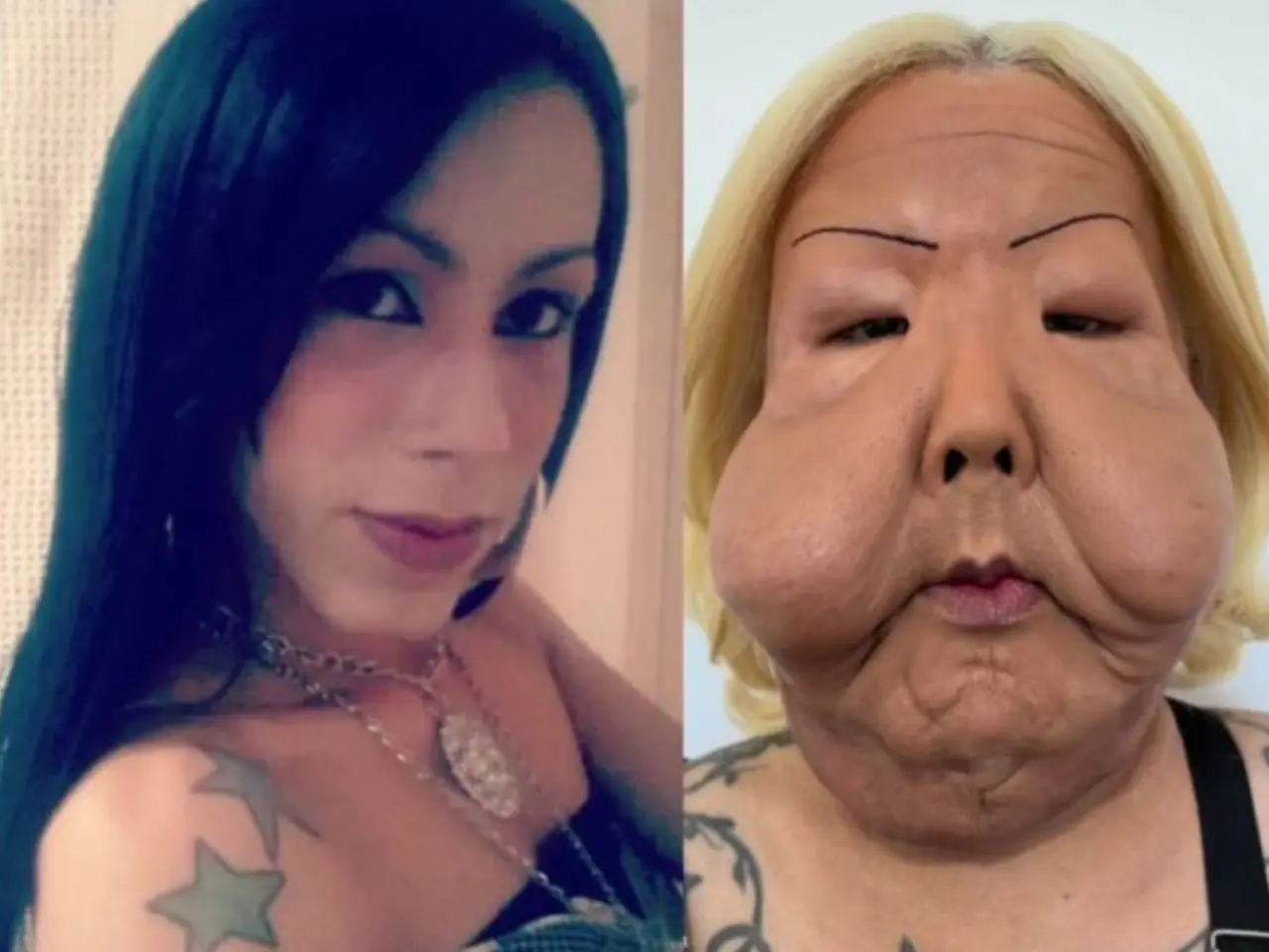 Veja antes e depois de Juju do Pix após primeira cirurgia