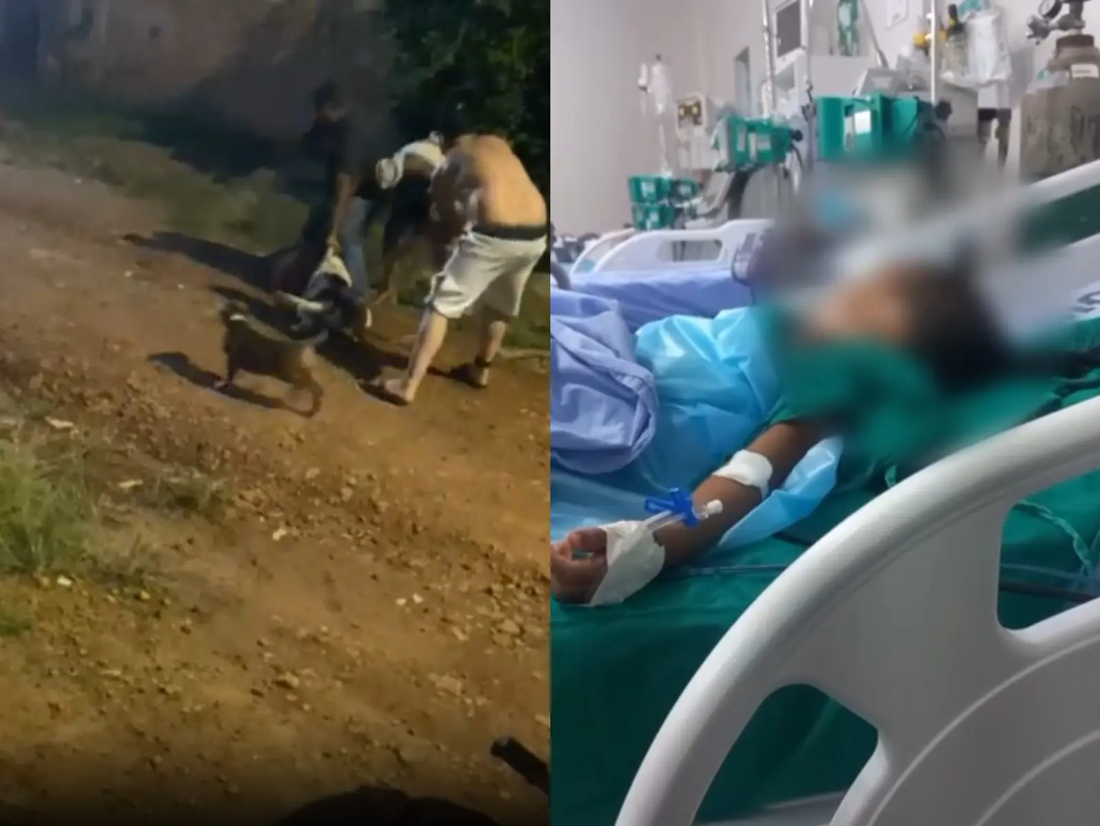 Vídeo: criança é atacada por pitbulls e polícia precisa intervir