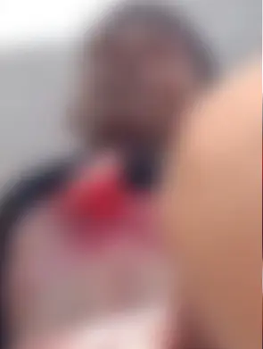 Motociclista bate em caminhão e fica com pulmão exposto (Foto: Reprodução)