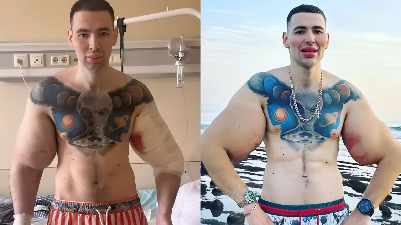 Reprodução