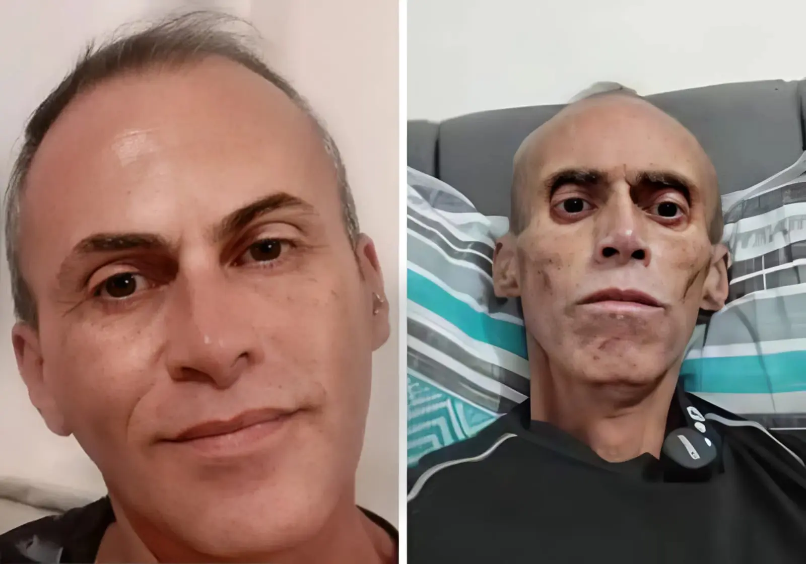 Morre Serginho Prussak, influenciador que emocionou ao compartilhar diário de internação por doença rara