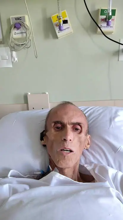 O que é a doença que atingiu Serginho Prussak? Influenciador relatou sintomas da ascite em vídeo