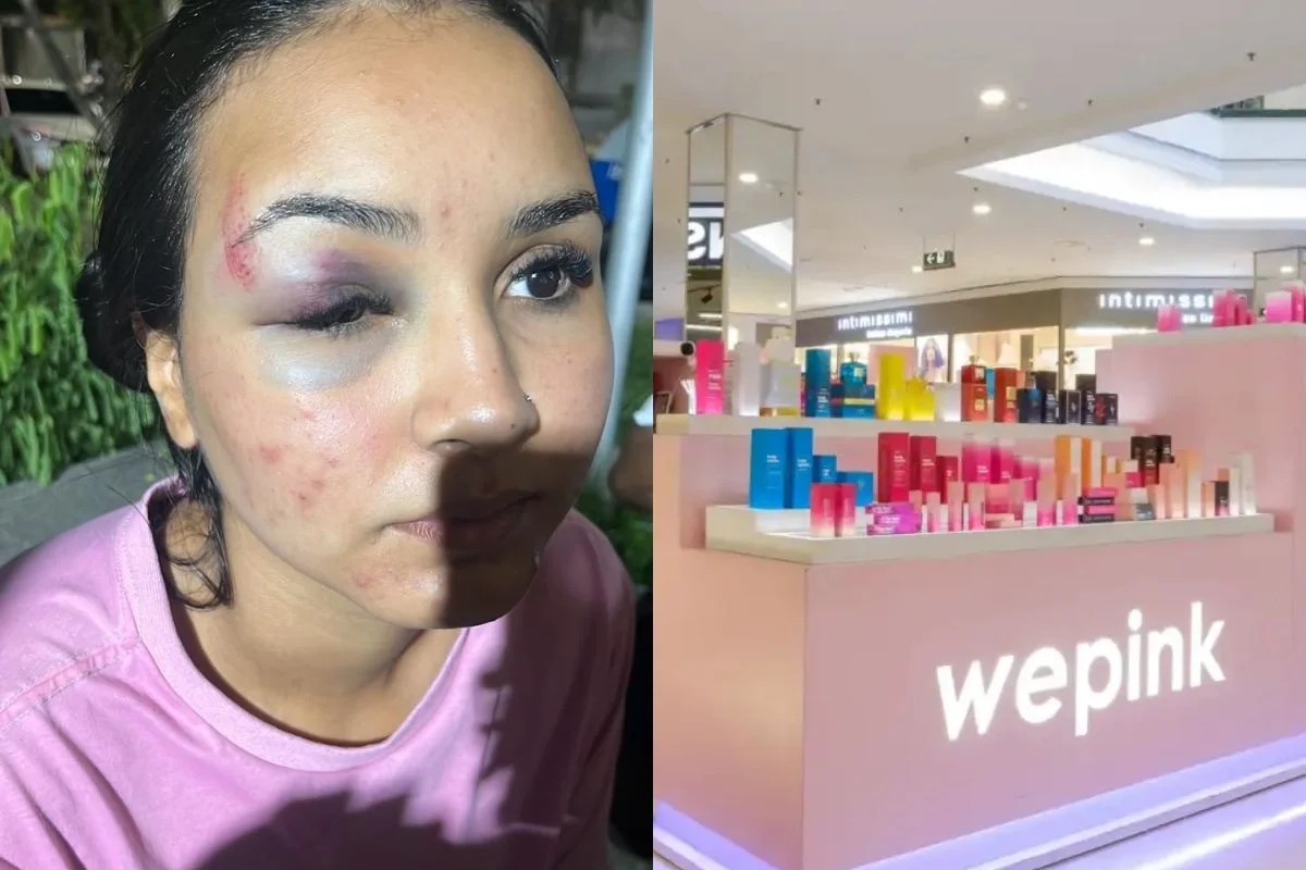 Veja estado de saúde de vendedora da marca de Virginia após agressão de cliente 
