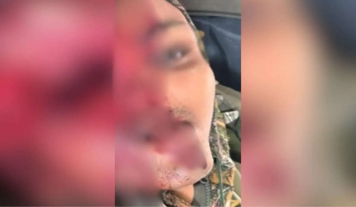 A foto vazada no X mostra detalhes do rosto do cadáver, com uma grande abertura na região frontal da face, causada pelo tiro. Reprodução redes sociais