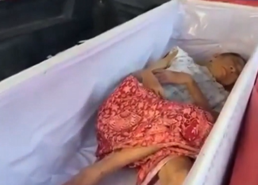 Mulher de 65 anos quase foi cremada viva (Foto: Reprodução)