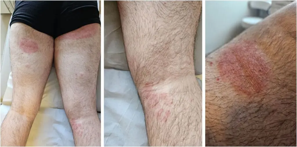Superfungo ultrapassou 250 registros nos últimos três anos (Foto: Reprodução)