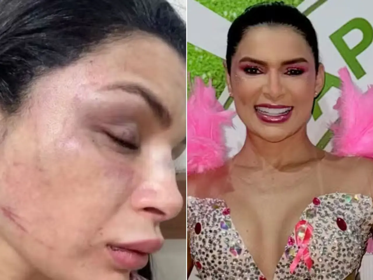 Musa de escola de samba dá nova versão após acusar motorista de aplicativo de roubo e agressão