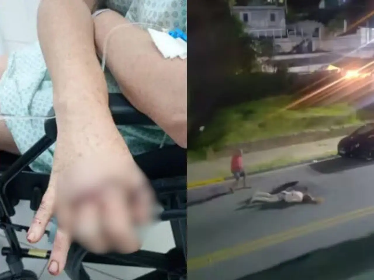 Homem que agrediu mulher com tacho volta ao local do crime e é espancado
