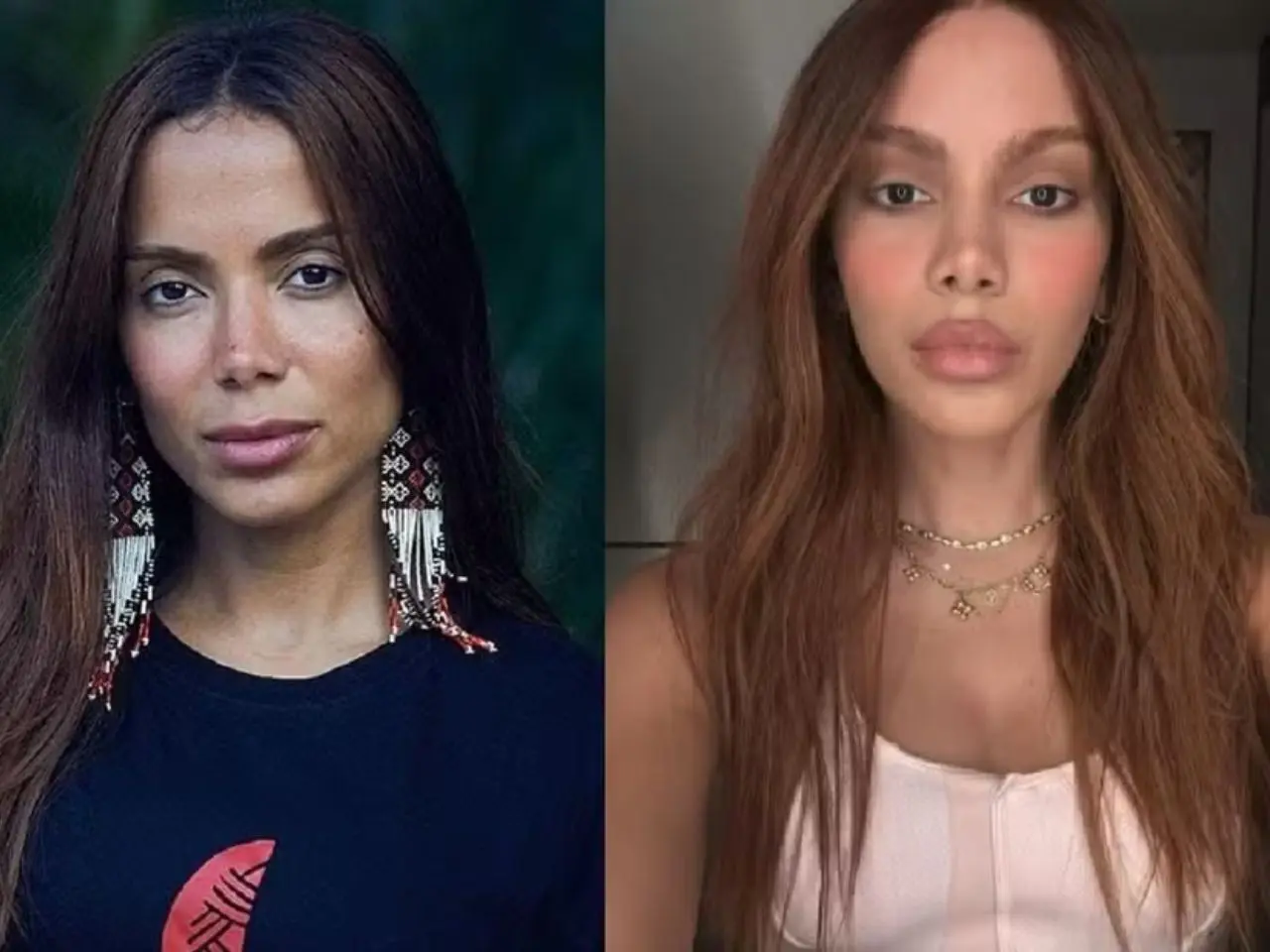 Anitta revela o que a motivou a fazer plásticas; veja