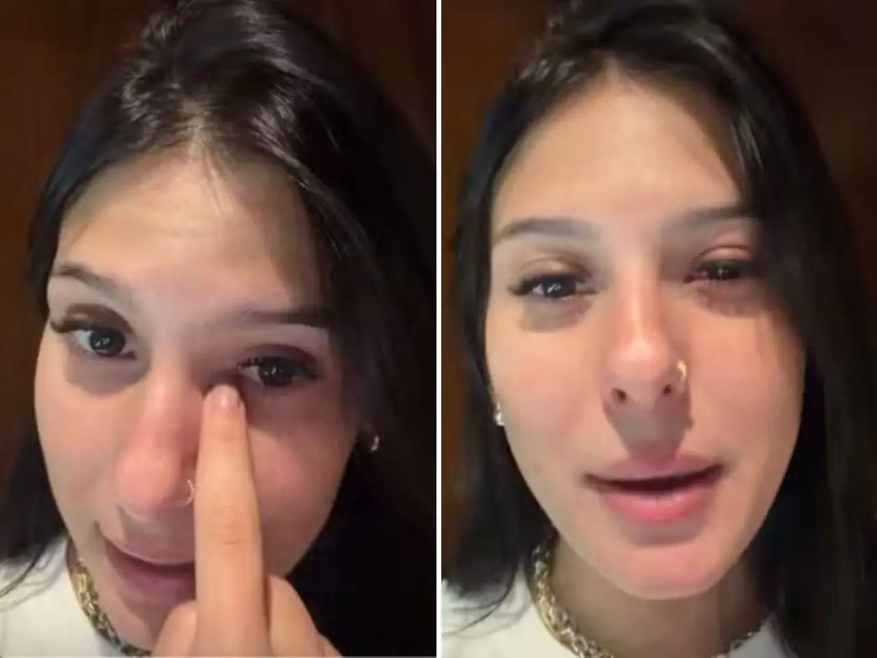 Ana Castela aparece com olho inchado e preocupa fãs; veja vídeo