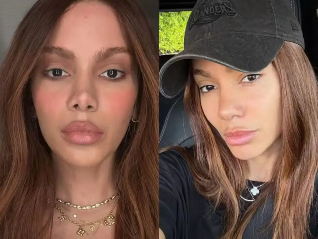 Em viagem aos Alpes, Anitta brinca sobre a própria aparência e gera repercussão nas redes sociais. Foto: Divulgação / Redes sociais.