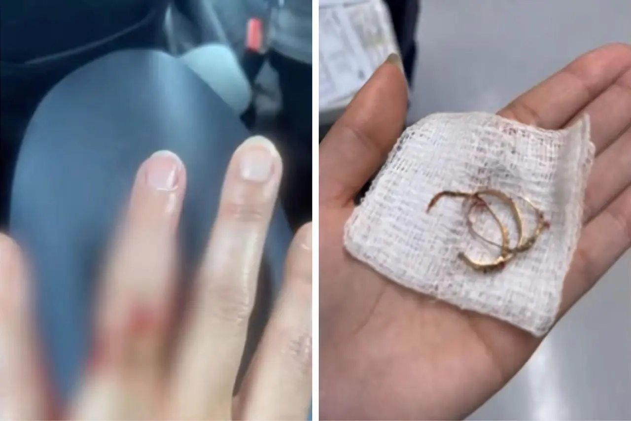 Mulher reage assalto e tem dedo mordido por assaltante - Reprodução: Record TV-Interior 